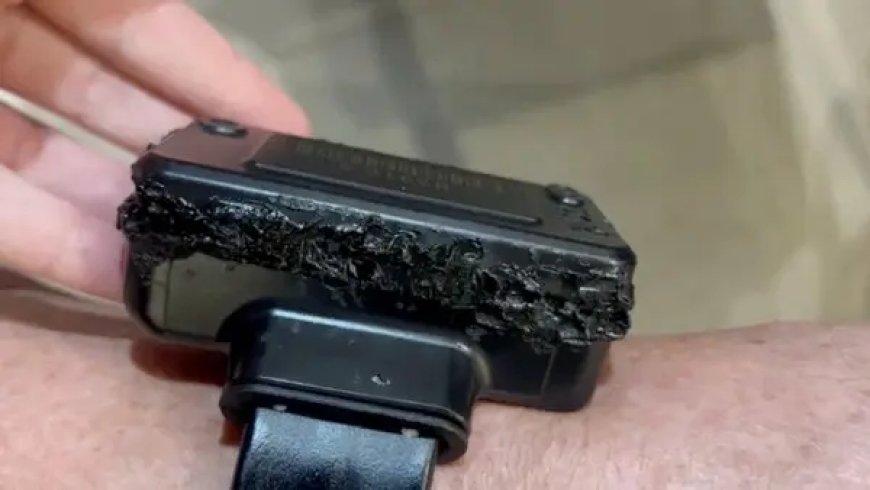 Bolsonaro Claims Medicine-Induced “Paranoia” and “Hallucinations” Led to Ankle Monitor Damage Amid Arrest