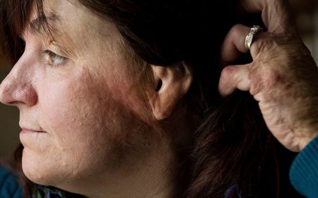 A Nightclub Fire Turned Deadly in 90 Seconds — I Barely Escaped