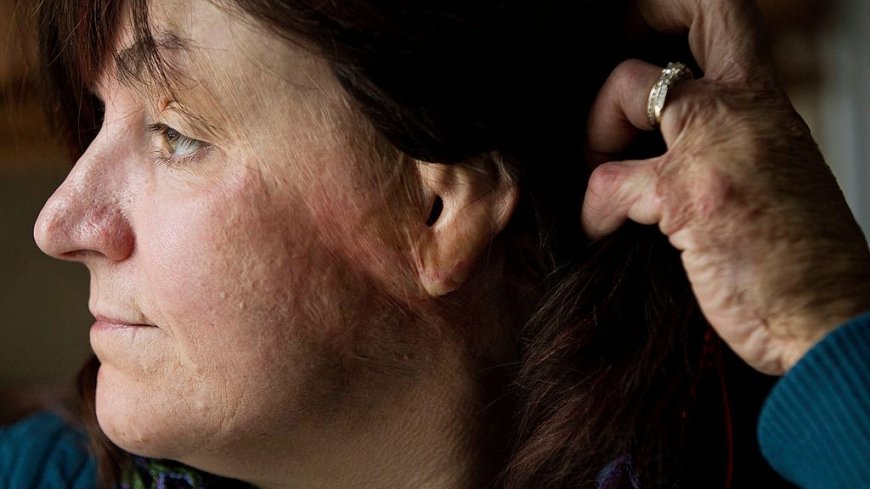 A Nightclub Fire Turned Deadly in 90 Seconds — I Barely Escaped